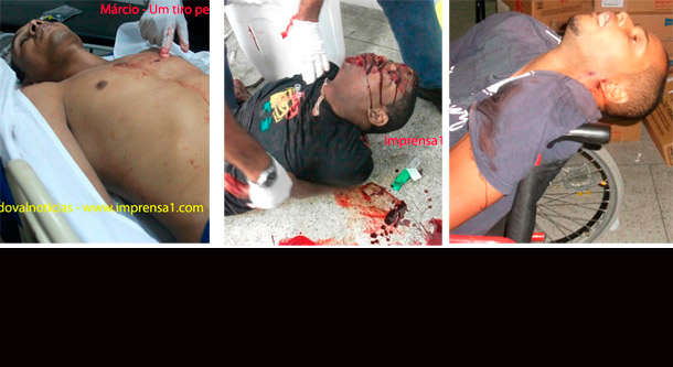 SLIDE-CHACINA--HUSE-02