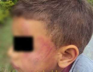 CRIANA-ESPANCADA-PELO-PAI