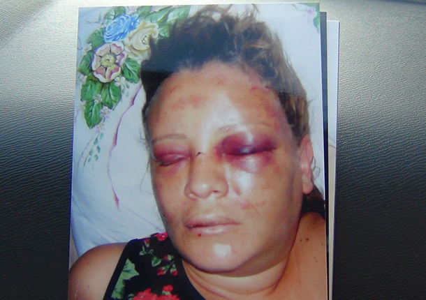 Mulher-quase-morre-apos-espancamento-4