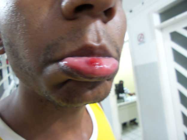 Homem é espancado pela namorada após um passeio