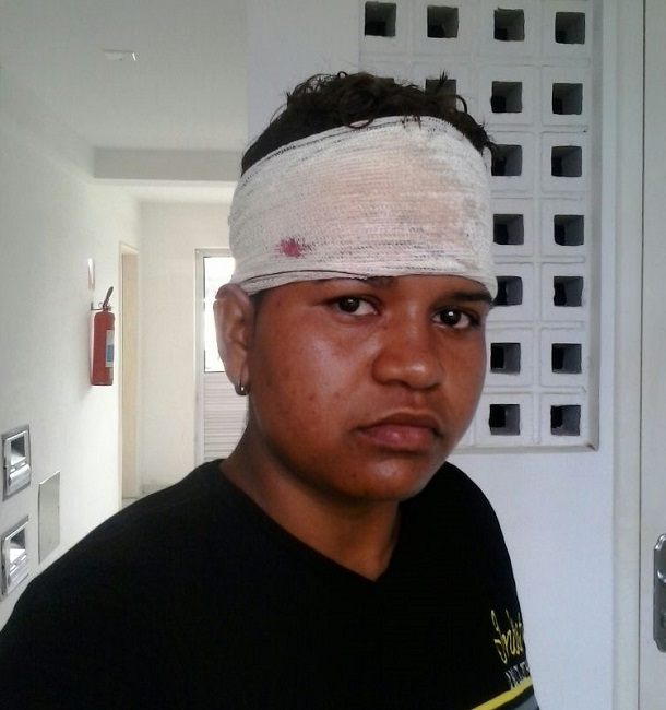 Mulher denúncia que foi agredida por policiais na Praia da Costa