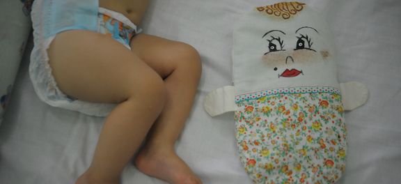 Brasil tem 270 casos de microcefalia confirmados