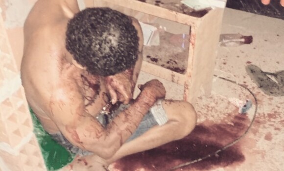 Casal é executado à tiros dentro de casa em Nossa Senhora das Dores