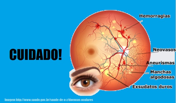Visita ao oftalmologista pode prevenir câncer nos olhos