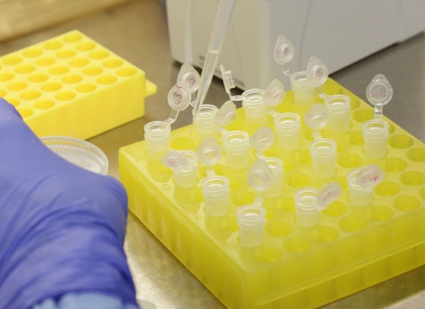 Governo de Sergipe confirma o sexto caso de CORONAVIRUS no Estado