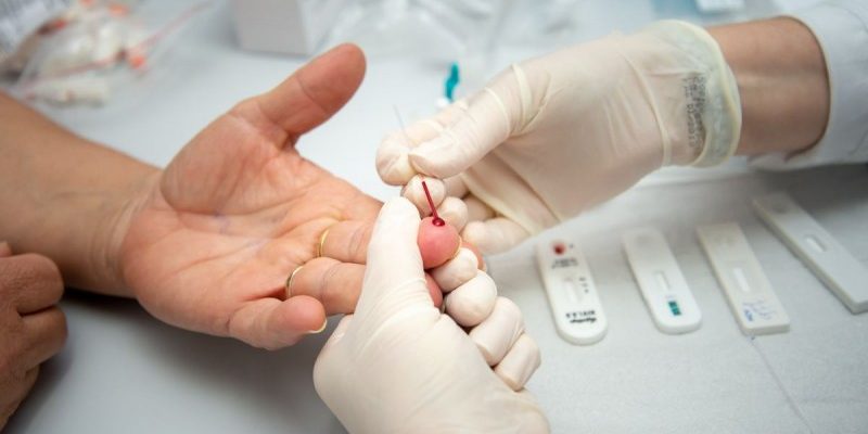 Prefeitura reforça cuidados para prevenção e tratamento de HIV/Aids