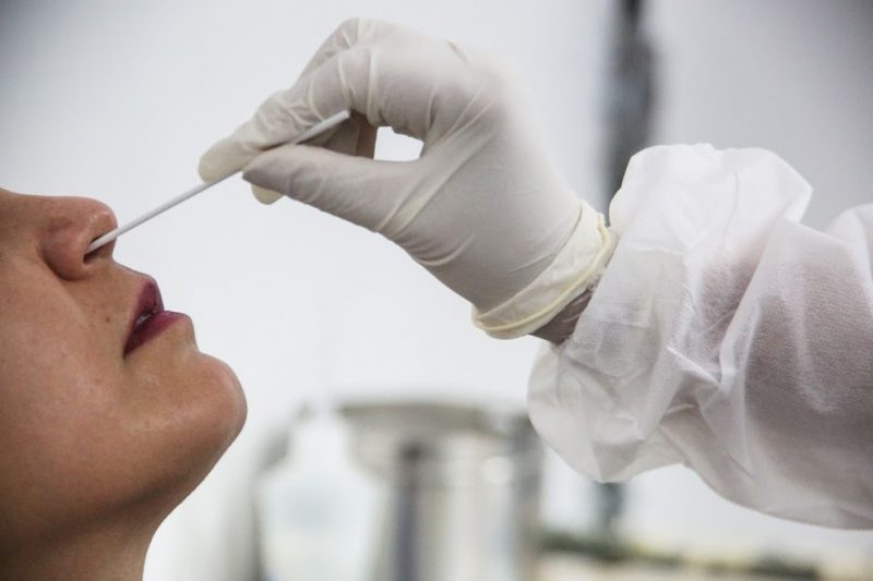 Ambulatório do Servidor realizou mais de 1.600 testes para Covid-19