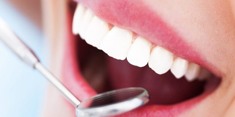 Hapvida apoia julho neon que atenta para a saúde bucal