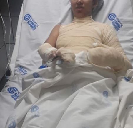 Suspeito de atear fogo na esposa grávida  de cinco meses é preso pelo DAGV