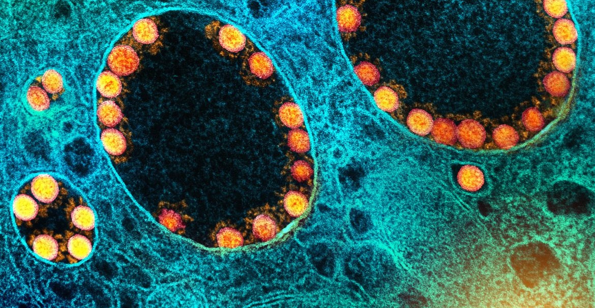 Vacinas agem contra covid grave, mesmo com nova variante