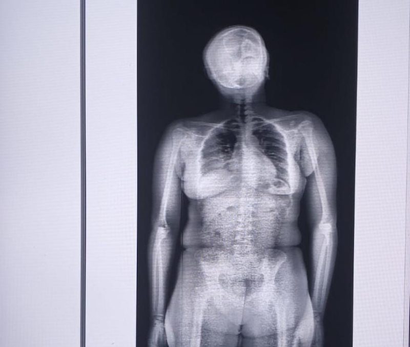 Mulher é presa suspeita de tentar entrar com drogas no Copemcan