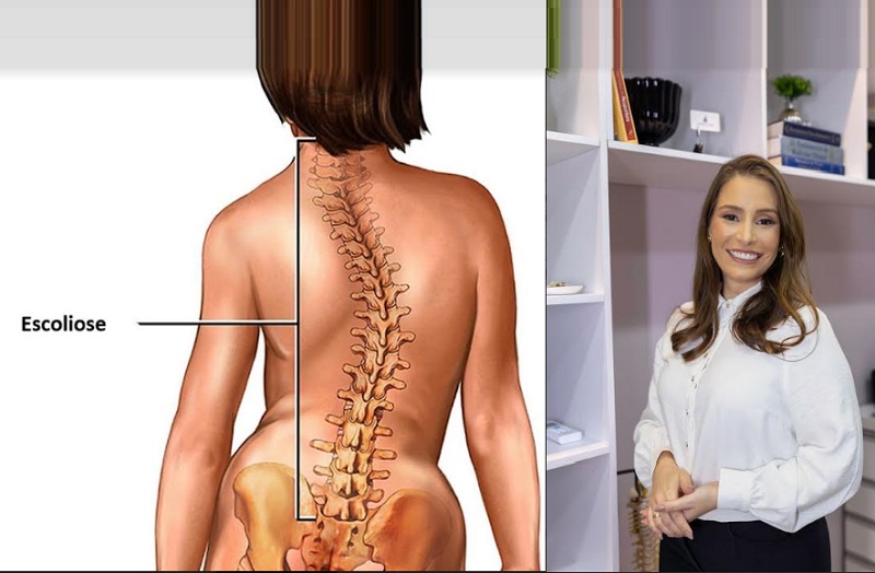 Junho verde em Sergipe: Dra. Letícia Gitaci alerta sobre a escoliose
