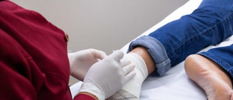 Ambulatório de Curativos do Centro de Endocrinologia e Diabetes aumenta número de atendimentos