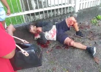 Homem é cortado de facão em tentativa de homicídio no Conjunto Fernando Collor