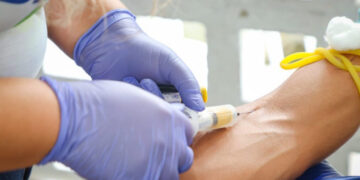 SES alerta para prevenção e diagnóstico precoce do HTLV em Sergipe