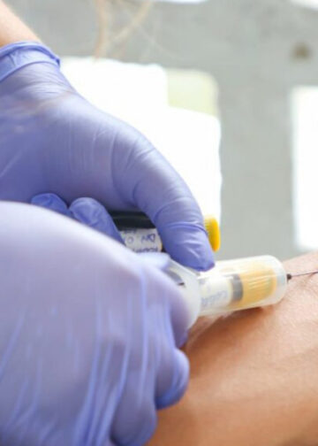 SES alerta para prevenção e diagnóstico precoce do HTLV em Sergipe