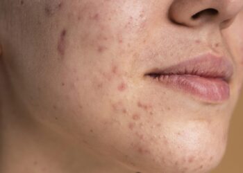 Alese aprova criação do Dia de Enfrentamento à Puberdade Precoce em Sergipe